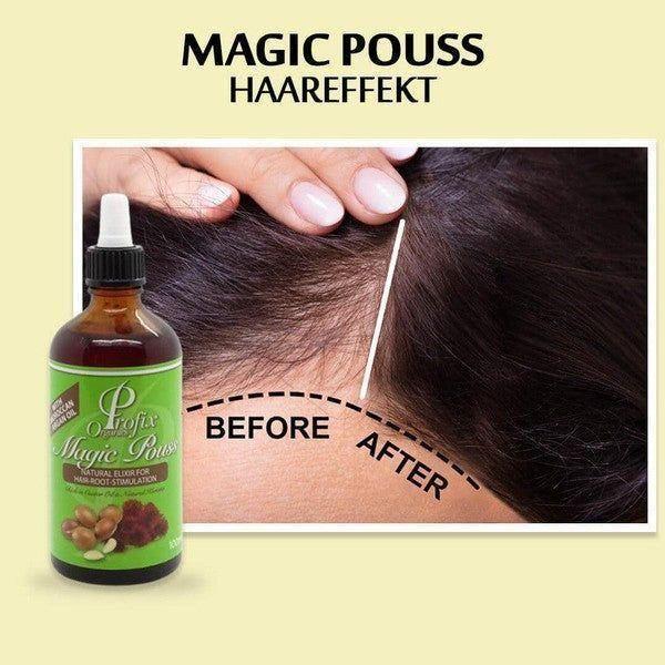 Profix Magic Pouss Natural Elixir for Hair-Root-Stimulation 100ml - Image 4