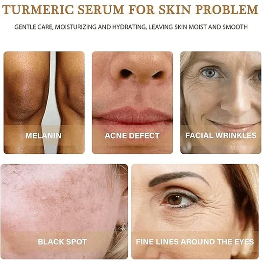 Turmeric Oil Serum 100% Pure & Natural 30ml - Image 4